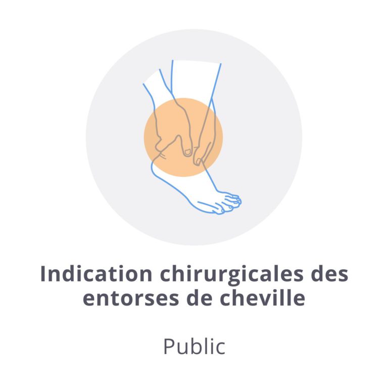 Lire la suite à propos de l’article Indication chirurgicales des entorses de cheville, quoi de neuf en 2022 ? 